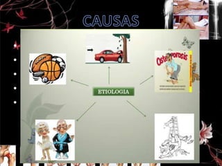 •
•
•
•
•

Enfermedades de los huesos.
Caída desde una altura.
Accidentes de coche, moto, etc.
Maltrato
Estrés o sobrecarga, fuerzas repetitivas
(provoca una fisura delgada del hueso)

 