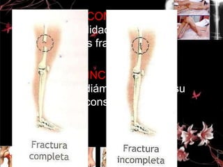 FRACTURA COMPLETA:
Afecta la totalidad del diámetro
óseo (2 o mas fragmentos)
FRACTURA INCOMPLETA:
No afecta el diámetro óseo en su
totalidad, se conserva de forma
parcial.

 