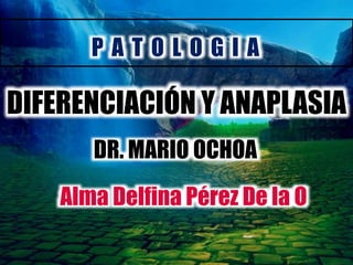 P A T O L O G I A 
DIFERENCIACIÓN Y ANAPLASIA 
DR. MARIO OCHOA 
Alma Delfina Pérez De la O 
 