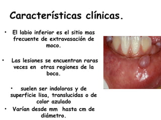 Lesiones Raras Patologia de las glandulas salivales.pptx