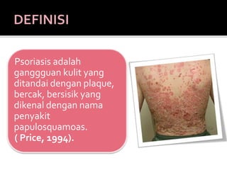Psoriasis adalah
ganggguan kulit yang
ditandai dengan plaque,
bercak, bersisik yang
dikenal dengan nama
penyakit
papulosquamoas.
( Price, 1994).
 
