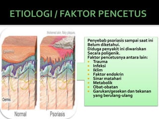 Penyebab psoriasis sampai saat ini
Belum diketahui.
Diduga penyakit ini diwariskan
Secara poligenik.
Faktor pencetusnya antara lain:
 Trauma
 Infeksi
 Iklim
 Faktor endokrin
 Sinar matahari
 Metabolik
 Obat-obatan
 Garukan/gesekan dan tekanan
yang berulang-ulang
 