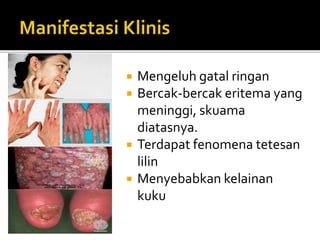  Mengeluh gatal ringan
 Bercak-bercak eritema yang
meninggi, skuama
diatasnya.
 Terdapat fenomena tetesan
lilin
 Menyebabkan kelainan
kuku
 