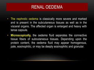 • The nephrotic oedema is classically more severe and marked
and is present in the subcutaneous tissues as well as in the
visceral organs. The affected organ is enlarged and heavy with
tense capsule.
• Microscopically, the oedema fluid separates the connective
tissue fibers of subcutaneous tissues. Depending upon the
protein content, the oedema fluid may appear homogenous,
pale, eosinophilic, or may be deeply eosinophilic and granular.
RENAL OEDEMA
 