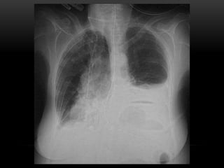 2nd Year Pathology
2010
 