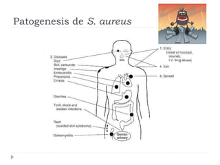 Patogenesis de S. aureus
 