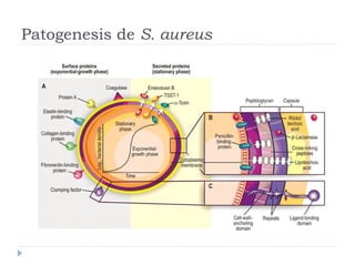 Patogenesis de S. aureus
 