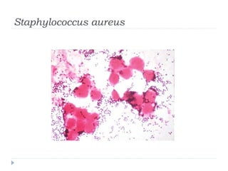 Staphylococcus aureus
 