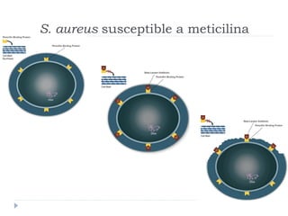 S. aureus susceptible a meticilina
 