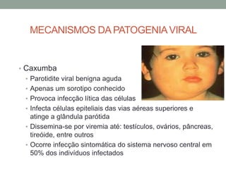 MECANISMOS DA PATOGENIAVIRAL
• Caxumba
• Parotidite viral benigna aguda
• Apenas um sorotipo conhecido
• Provoca infecção lítica das células
• Infecta células epiteliais das vias aéreas superiores e
atinge a glândula parótida
• Dissemina-se por viremia até: testículos, ovários, pâncreas,
tireóide, entre outros
• Ocorre infecção sintomática do sistema nervoso central em
50% dos indivíduos infectados
 