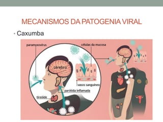 MECANISMOS DA PATOGENIAVIRAL
• Caxumba
 