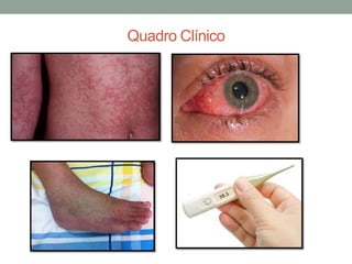 Quadro Clínico
 
