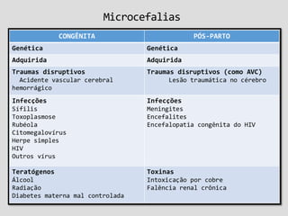 Microcefalias
 