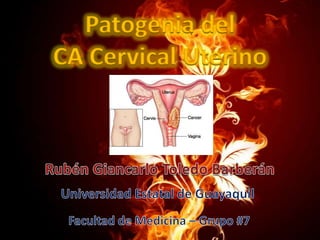 Patogenia del
CA Cervical Uterino

 