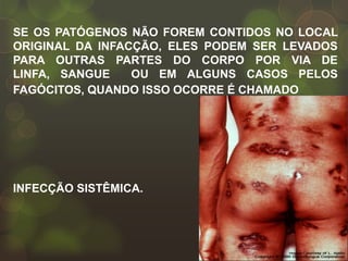 SE OS PATÓGENOS NÃO FOREM CONTIDOS NO LOCAL
ORIGINAL DA INFACÇÃO, ELES PODEM SER LEVADOS
PARA OUTRAS PARTES DO CORPO POR VIA DE
LINFA, SANGUE    OU EM ALGUNS CASOS PELOS
FAGÓCITOS, QUANDO ISSO OCORRE É CHAMADO




INFECÇÃO SISTÊMICA.
 