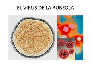 EL VIRUS DE LA RUBEOLA
 
