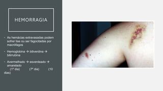 HEMORRAGIA
• As hemácias extravasadas podem
sofrer lise ou ser fagocitadas por
macrófagos
• Hemoglobina  biliverdina 
bilirrubina
• Avermelhado  esverdeado 
amarelado
(1º dia) (7º dia) (10
dias)
 