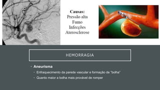 HEMORRAGIA
• Aneurisma
• Enfraquecimento da parede vascular e formação de ”bolha”
• Quanto maior a bolha mais provável de romper
 