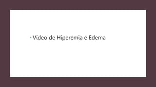 • Vídeo de Hiperemia e Edema
 