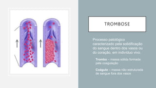 TROMBOSE
• Processo patológico
caracterizado pela solidificação
do sangue dentro dos vasos ou
do coração, em indivíduo vivo.
• Trombo – massa sólida formada
pela coagulação
• Coágulo – massa não estruturada
de sangue fora dos vasos
 