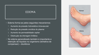 EDEMA
• Edema forma-se pelos seguintes mecanismos:
1. Aumento da pressão hidrostática intravascular
2. Redução da pressão oncótica do plasma
3. Aumento da permeabilidade capilar
4. Obstrução da drenagem linfática
• No edema generalizado também é importante a
retenção de líquidos no organismo (tentativa de
compensar) – diuréticos
 