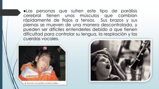 ●Las personas que sufren este tipo de parálisis
cerebral tienen unos músculos que cambian
rápidamente de flojos a tensos. Sus brazos y sus
piernas se mueven de una manera descontrolada, y
pueden ser difíciles entenderles debido a que tienen
dificultad para controlar su lengua, la respiración y las
cuerdas vocales.
 