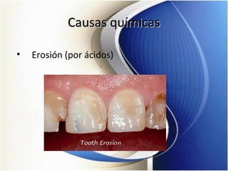 Causas químicasCausas químicas
• Erosión (por ácidos)
 
