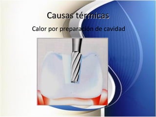 Causas térmicasCausas térmicas
Calor por preparación de cavidad
 