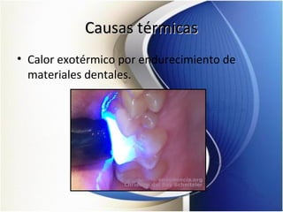 Causas térmicasCausas térmicas
• Calor exotérmico por endurecimiento de
materiales dentales.
 
