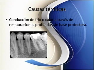 Causas térmicasCausas térmicas
• Conducción de frío o calor a través de
restauraciones profundas sin base protectora.
 