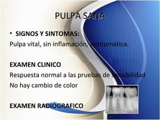 PULPA SANAPULPA SANA
• SIGNOS Y SINTOMAS:
Pulpa vital, sin inflamación, asintomática.
EXAMEN CLINICO
Respuesta normal a las pruebas de sensibilidad
No hay cambio de color
EXAMEN RADIOGRAFICO
 