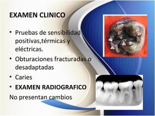 EXAMEN CLINICO
• Pruebas de sensibilidad
positivas,térmicas y
eléctricas.
• Obturaciones fracturadas o
desadaptadas
• Caries
• EXAMEN RADIOGRAFICO
No presentan cambios
 