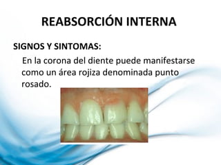 REABSORCIÓN INTERNA
SIGNOS Y SINTOMAS:
En la corona del diente puede manifestarse
como un área rojiza denominada punto
rosado.
 