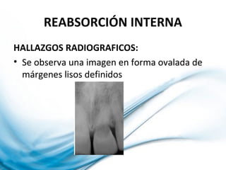 REABSORCIÓN INTERNA
HALLAZGOS RADIOGRAFICOS:
• Se observa una imagen en forma ovalada de
márgenes lisos definidos
 