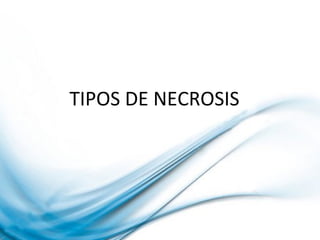 TIPOS DE NECROSIS
 