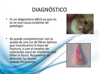 DIAGNÓSTICO
• Es un diagnóstico difícil ya que no
se ve una causa evidente de
patología.
• Se puede complementar con la
ayuda de una luz de fibras ópticas
que transilumine la línea de
fractura, o con el empleo de
colorantes (azul de metileno) que
tiñan la fisura. Raramente se
detectan las fisuras
radiográficamente.
 