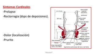 Síntomas Cardinales
-Prolapso
-Rectorragia (dsps de deposiones).
-Dolor (localización)
-Prurito
MyluskaT
 