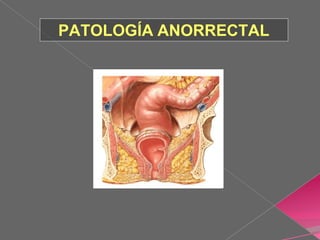 PATOLOGÍA ANORRECTAL
 