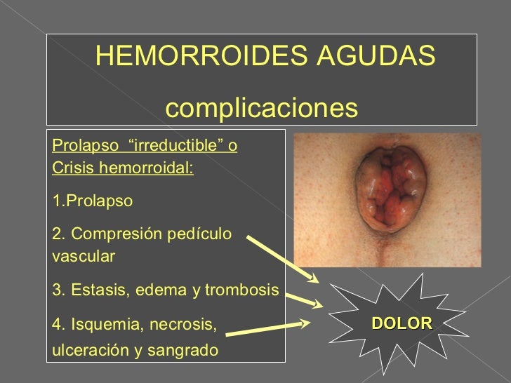 PatologíA Anorectal Y AtencióN Primaria PatologíA Anorectal Y AtencióN Primaria