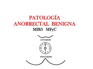PATOLOGÍA
ANORRECTAL BENIGNA
     MIR3 MFyC
 