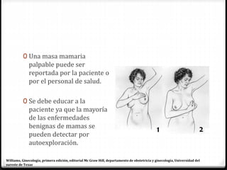 0 Una masa mamaria
palpable puede ser
reportada por la paciente o
por el personal de salud.
0 Se debe educar a la
paciente ya que la mayoría
de las enfermedades
benignas de mamas se
pueden detectar por
autoexploración.
Williams, Ginecología, primera edición, editorial Mc Graw Hill, departamento de obstetricia y ginecología, Universidad del
sureste de Texas
 