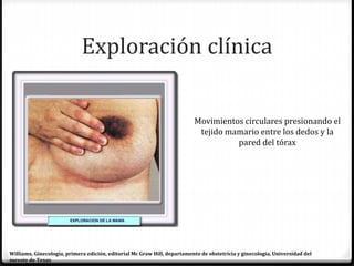 Exploración clínica
Movimientos circulares presionando el
tejido mamario entre los dedos y la
pared del tórax
Williams, Ginecología, primera edición, editorial Mc Graw Hill, departamento de obstetricia y ginecología, Universidad del
sureste de Texas
 