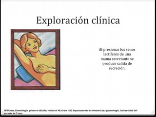 Exploración clínica
Al presionar los senos
lactíferos de una
mama secretante se
produce salida de
secreción.
Williams, Ginecología, primera edición, editorial Mc Graw Hill, departamento de obstetricia y ginecología, Universidad del
sureste de Texas
 