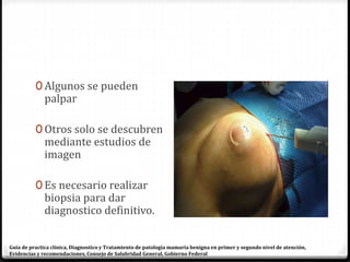 0 Algunos se pueden
palpar
0 Otros solo se descubren
mediante estudios de
imagen
0 Es necesario realizar
biopsia para dar
diagnostico definitivo.
Guía de practica clínica, Diagnostico y Tratamiento de patología mamaria benigna en primer y segundo nivel de atención,
Evidencias y recomendaciones, Consejo de Salubridad General, Gobierno Federal
 