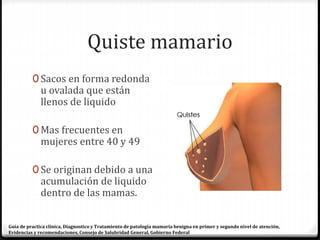 Quiste mamario
0 Sacos en forma redonda
u ovalada que están
llenos de liquido
0 Mas frecuentes en
mujeres entre 40 y 49
0 Se originan debido a una
acumulación de liquido
dentro de las mamas.
Guía de practica clínica, Diagnostico y Tratamiento de patología mamaria benigna en primer y segundo nivel de atención,
Evidencias y recomendaciones, Consejo de Salubridad General, Gobierno Federal
 