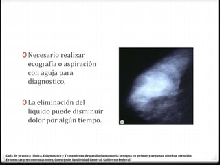 0 Necesario realizar
ecografía o aspiración
con aguja para
diagnostico.
0 La eliminación del
liquido puede disminuir
dolor por algún tiempo.
Guía de practica clínica, Diagnostico y Tratamiento de patología mamaria benigna en primer y segundo nivel de atención,
Evidencias y recomendaciones, Consejo de Salubridad General, Gobierno Federal
 