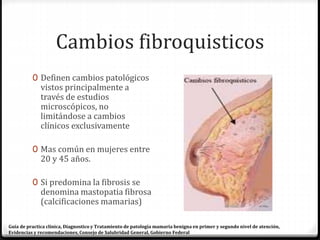Cambios fibroquisticos
0 Definen cambios patológicos
vistos principalmente a
través de estudios
microscópicos, no
limitándose a cambios
clínicos exclusivamente
0 Mas común en mujeres entre
20 y 45 años.
0 Si predomina la fibrosis se
denomina mastopatia fibrosa
(calcificaciones mamarias)
Guía de practica clínica, Diagnostico y Tratamiento de patología mamaria benigna en primer y segundo nivel de atención,
Evidencias y recomendaciones, Consejo de Salubridad General, Gobierno Federal
 