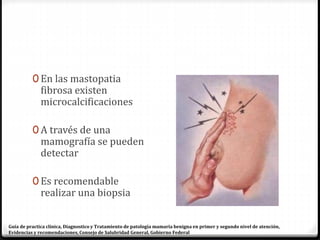 0 En las mastopatia
fibrosa existen
microcalcificaciones
0 A través de una
mamografía se pueden
detectar
0 Es recomendable
realizar una biopsia
Guía de practica clínica, Diagnostico y Tratamiento de patología mamaria benigna en primer y segundo nivel de atención,
Evidencias y recomendaciones, Consejo de Salubridad General, Gobierno Federal
 