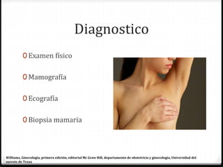 Diagnostico
0 Examen físico
0 Mamografía
0 Ecografía
0 Biopsia mamaria
Williams, Ginecología, primera edición, editorial Mc Graw Hill, departamento de obstetricia y ginecología, Universidad del
sureste de Texas
 