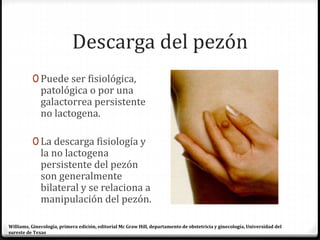 Descarga del pezón
0 Puede ser fisiológica,
patológica o por una
galactorrea persistente
no lactogena.
0 La descarga fisiología y
la no lactogena
persistente del pezón
son generalmente
bilateral y se relaciona a
manipulación del pezón.
Williams, Ginecología, primera edición, editorial Mc Graw Hill, departamento de obstetricia y ginecología, Universidad del
sureste de Texas
 